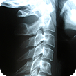 Visit X-Ray